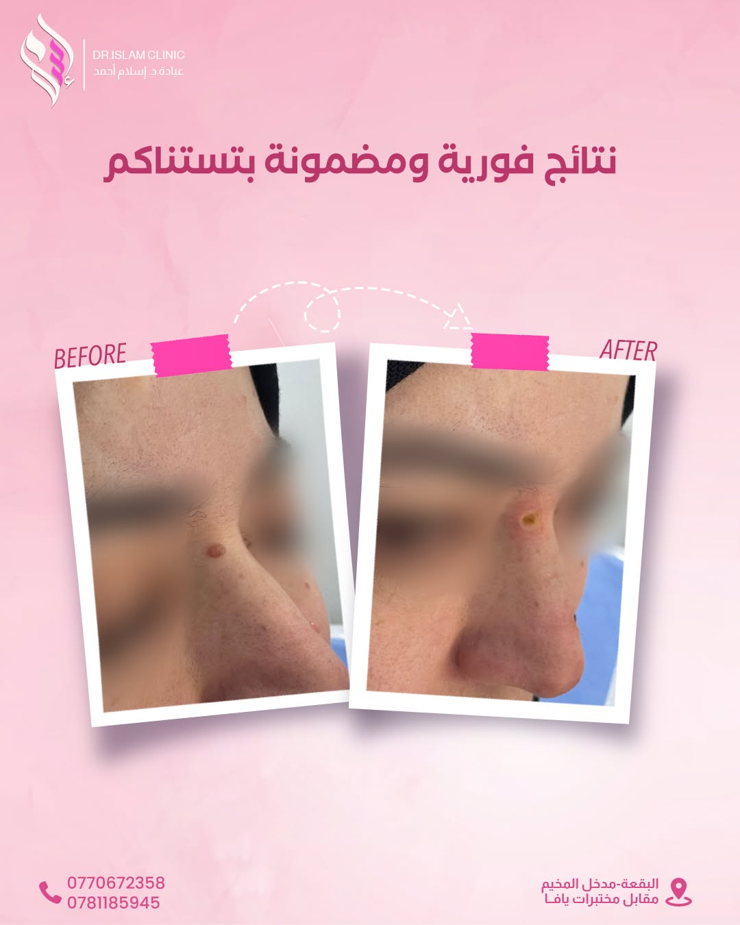قبل وبعد 5